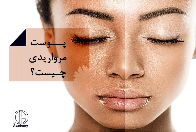 مراقبت_های-قبل-و-بعد-از-ژل-کربوکسی-تراپی111
