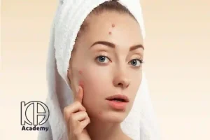 چرا بعد از فیشیال جوش می‌زنم؟ دلایل و راهکارهای پیشگیری جوش زدن بعد از فیشیال