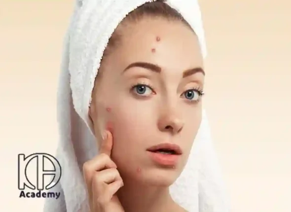 چرا بعد از فیشیال جوش می‌زنم؟ دلایل و راهکارهای پیشگیری جوش زدن بعد از فیشیال