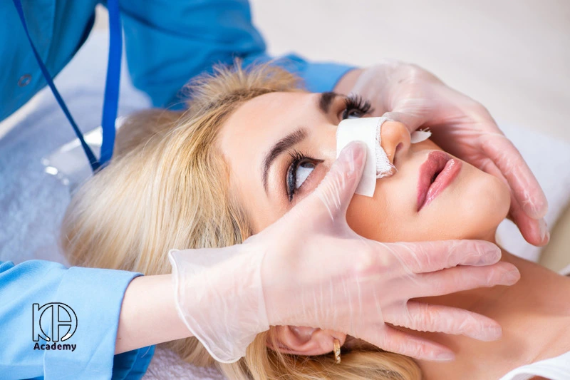 فیشیال بعد از عمل بینی