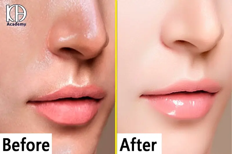 مراحل فیشیال تخصصی پوست چرب