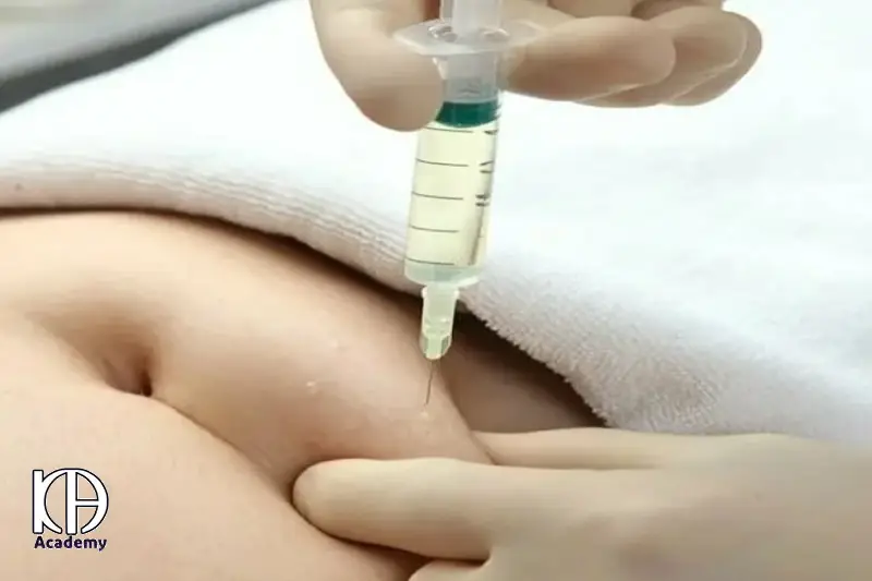 مقایسه مزوتراپی شکم با سایر روش های لاغری