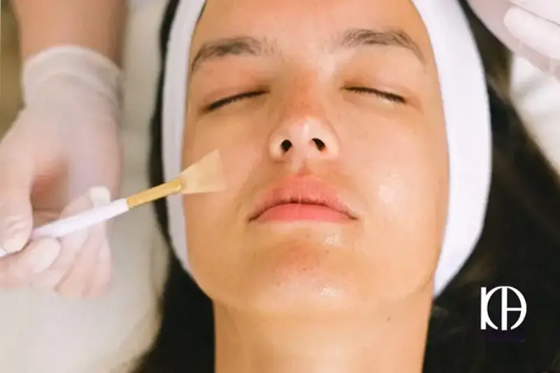 10 تا از مهمترین مراقبت های بعد از فیشیال صورت