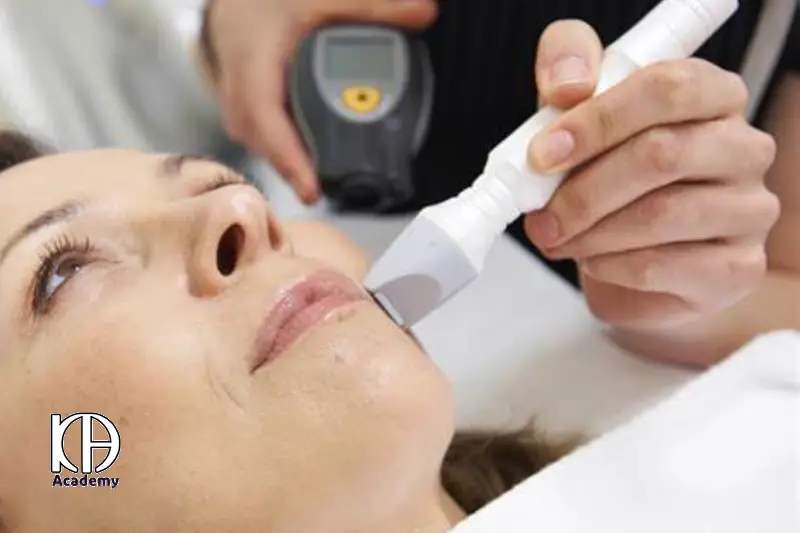 میکرودرم آبریژن چیست