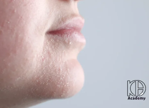 فیشیال برای پوست دهیدراته چیست